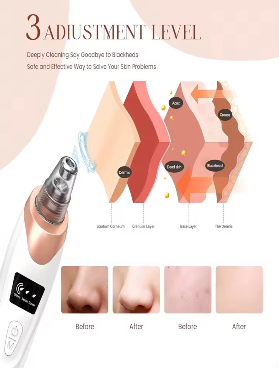 A skincare cleansing device shown on a clean light background with explanatory text and layered skin diagram. The ad includes the product at lower left, a cross-section illustration of skin layers with labels, and four before/after skin close-ups labeled Before and After.