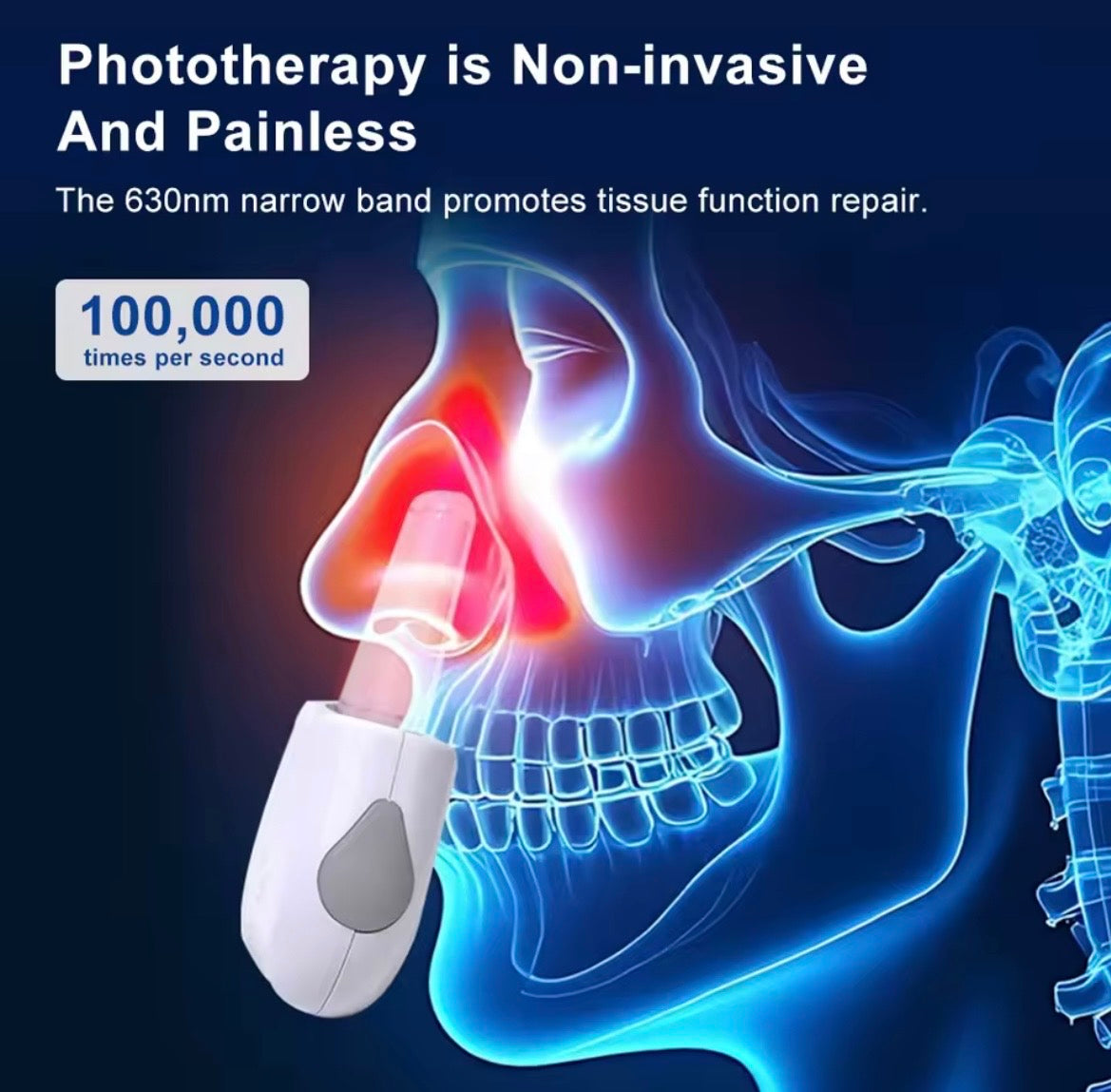 A white and gray phototherapy nasal device shown applying light to a nose in a blue anatomical illustration of a human head. Text reads 'Phototherapy is Non-invasive And Painless' and '100,000 times per second.