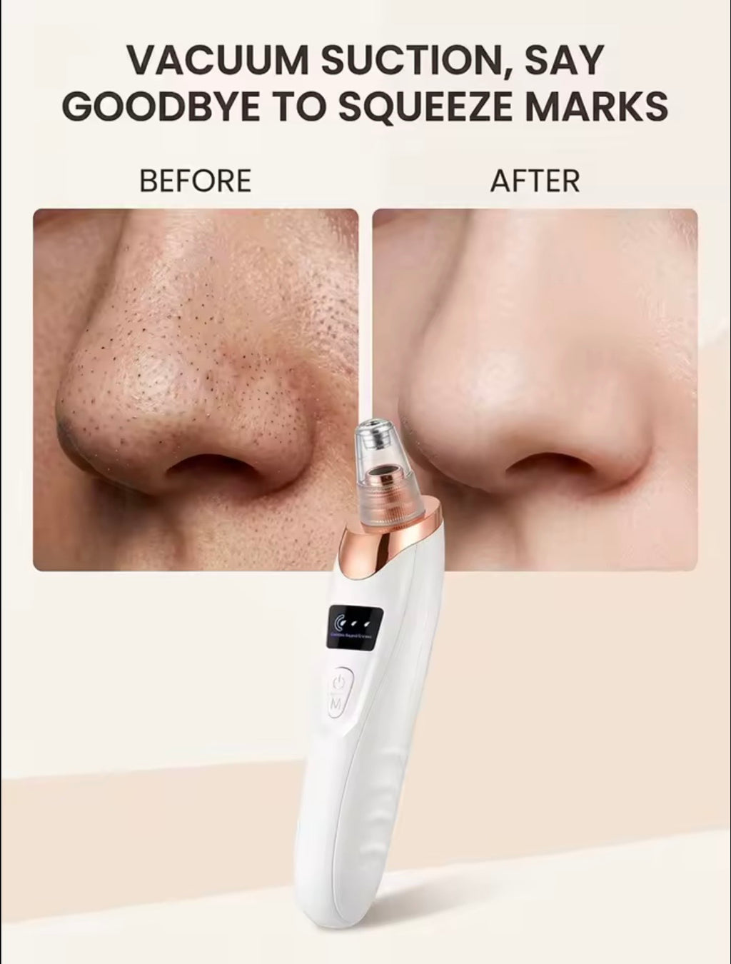 A white and rose gold facial cleansing device is shown below a before-and-after comparison of a nose with black comedones and clear pores. The text at the top reads 'VACUUM SUCTION, SAY GOODBYE TO SQUEEZE MARKS'.