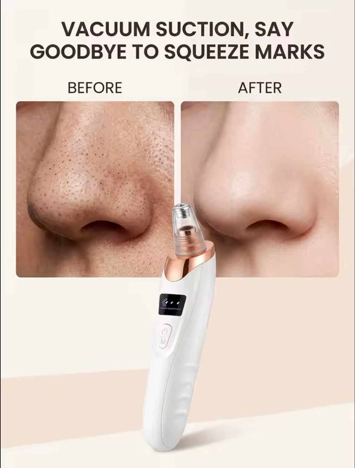 A white and rose gold facial cleansing device is shown below a before-and-after comparison of a nose with black comedones and clear pores. The text at the top reads 'VACUUM SUCTION, SAY GOODBYE TO SQUEEZE MARKS'.